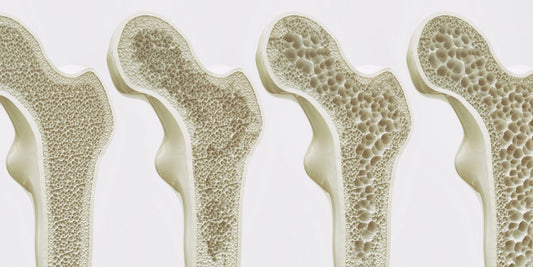 What is osteoporosis?